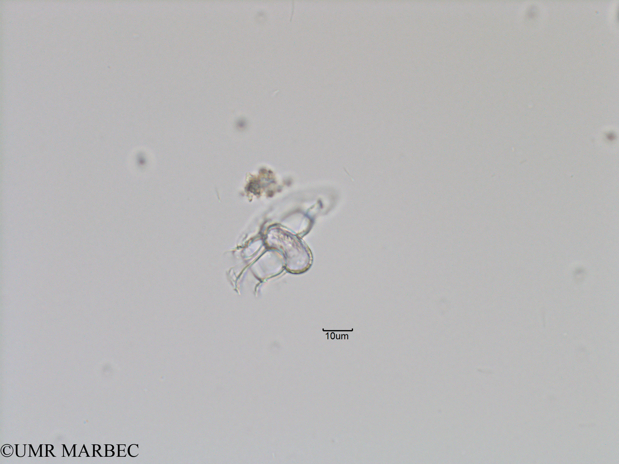 phyto/Bizerte/bizerte_bay/RISCO November 2015/Histioneis sp1 (Baie_T5-C2-Histioneis-7).tif(copy).jpg